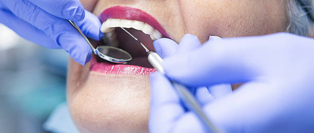 Best Broken or Chipped Tooth Repair in Altamont, NY
